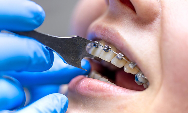 Orthodontics